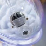 Invasive Brain-Computer Interfaces: China Fires the First Shot